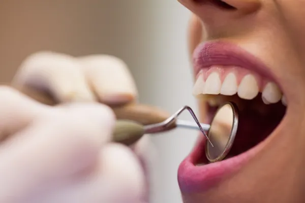 dentist-examining-female-patient-with-tools.jpg